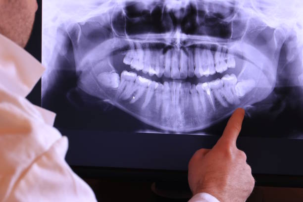 Best Emergency Treatment for Toothache in Soh Weber, UT
