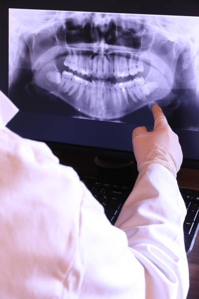 Best Emergency Wisdom Teeth Removal in Soh Weber, UT