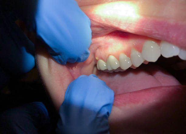 Best After-Hours Emergency Dentist in Soh Weber, UT