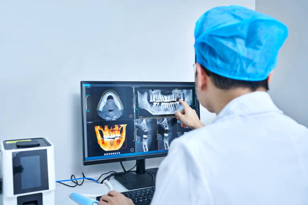 Best Emergency Wisdom Teeth Removal in Soh Weber, UT
